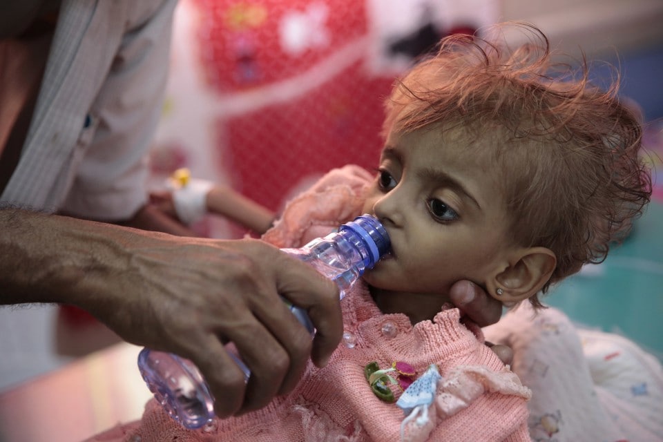 Yemen’s looming famine has been a long time coming