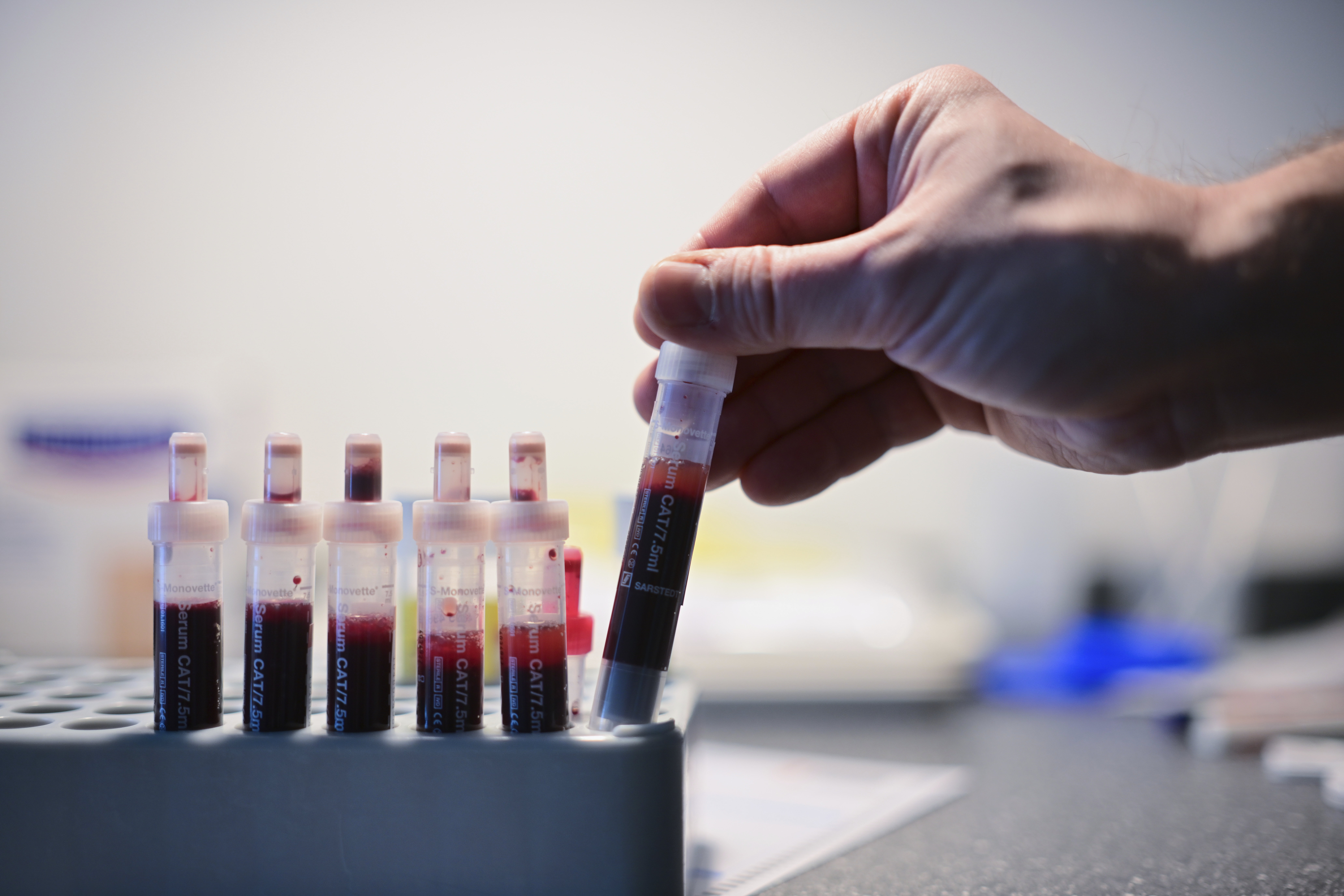 (Sebastian Gollnow/AP)