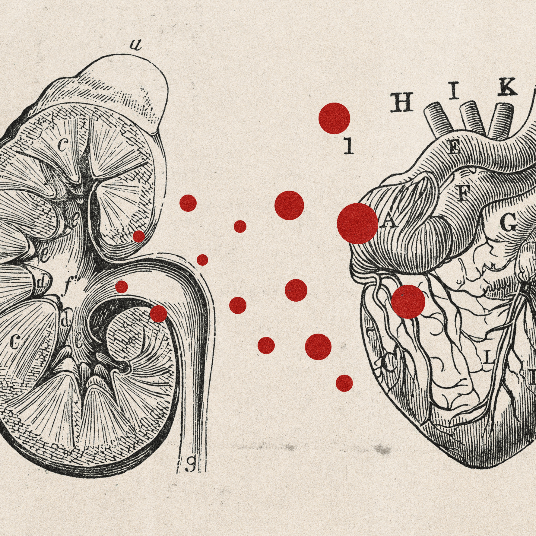 دانشمندان بالاخره شاید بدانند چرا بیماران کلیوی از بیماری قلبی می‌میرند